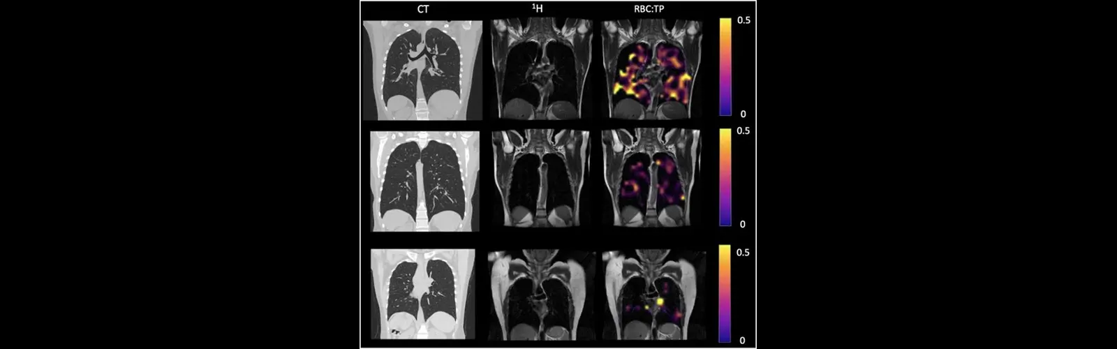 What Do CT Chest 3D Reports Show?